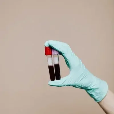 Close-up of a gloved hand holding test tubes with blood samples against a neutral background.